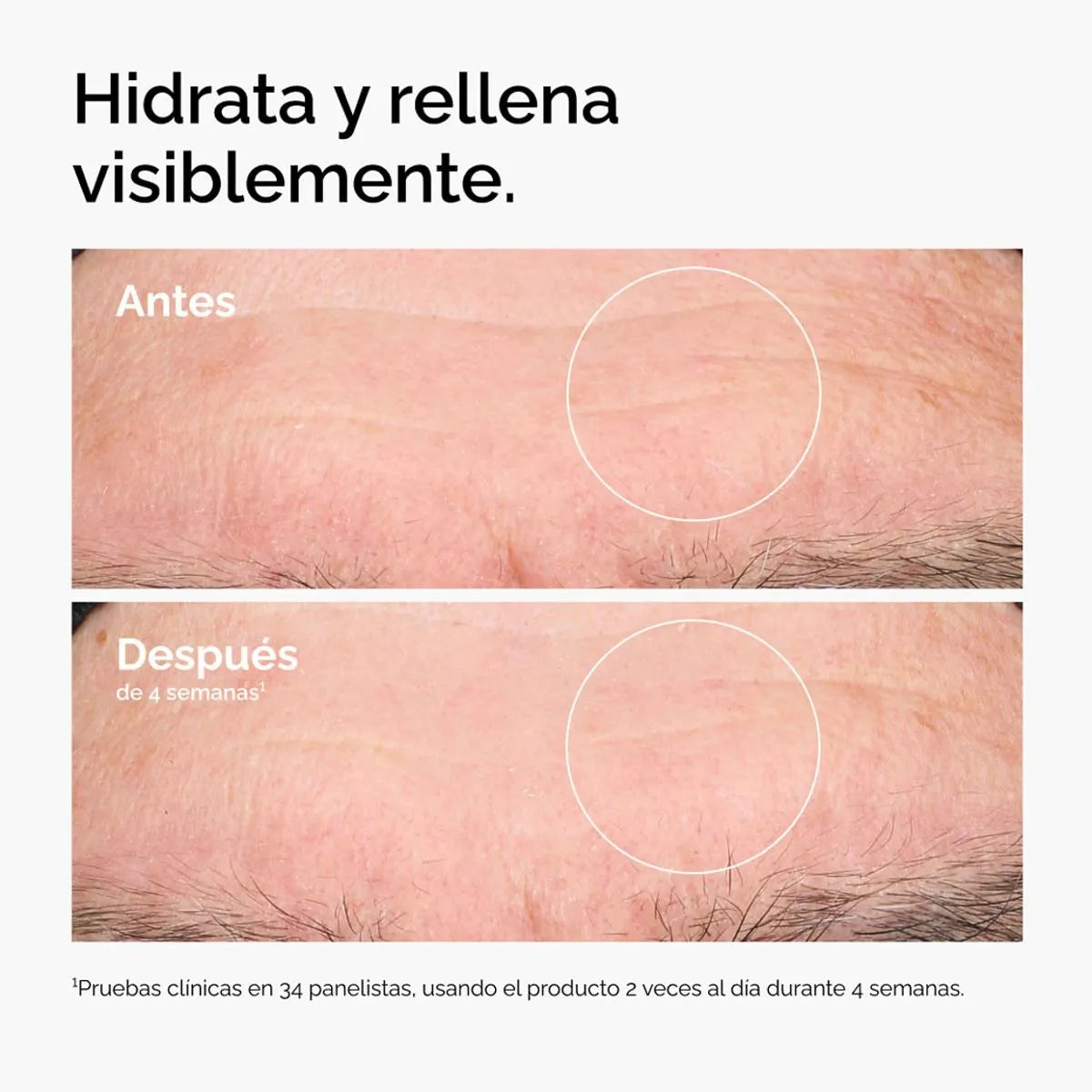 Acido Hialuronico 2% + B5  The Ordinary